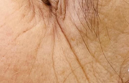 Hautpflege und Hautstruktur. Behandlung im Kosmetikstudio Duisburg.